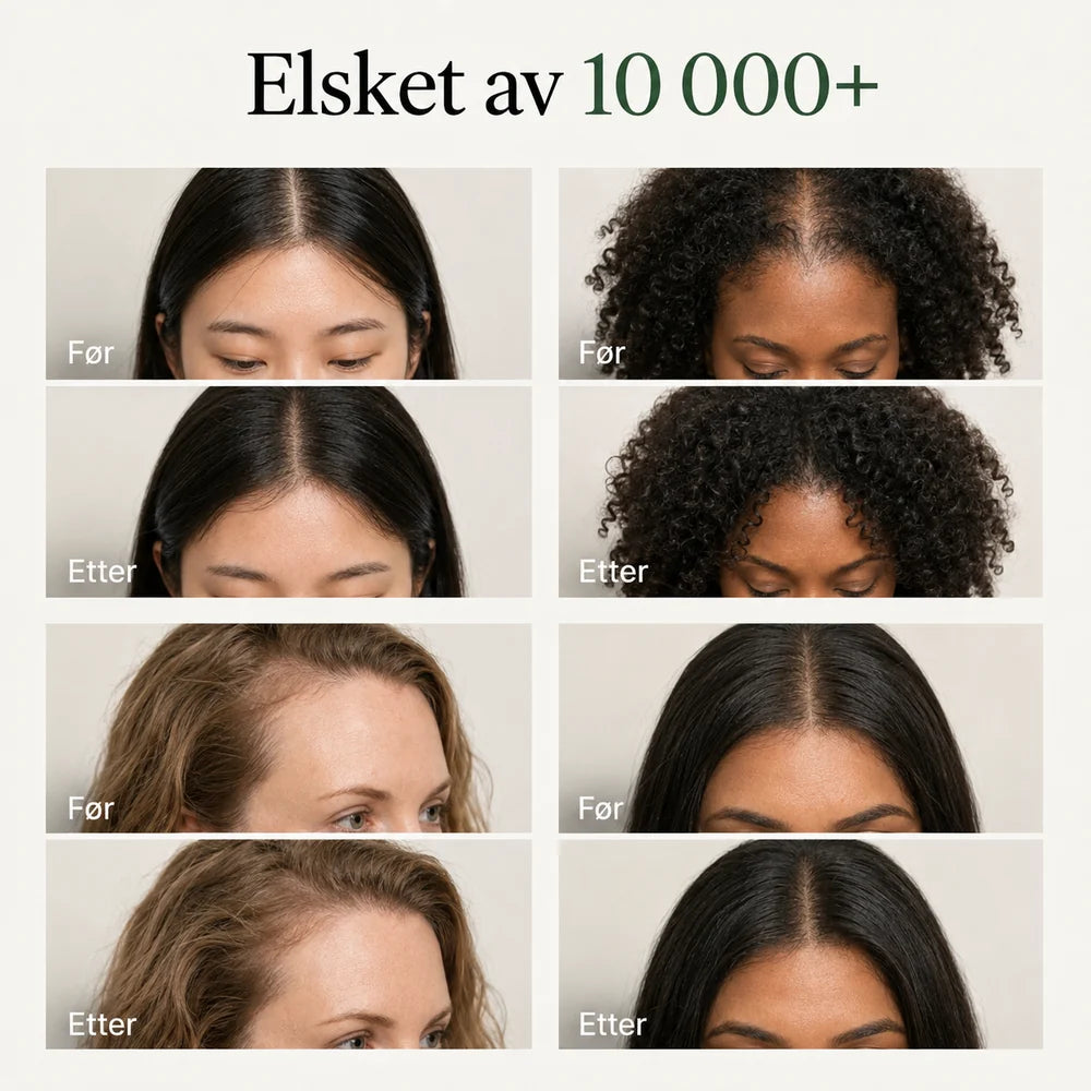 Før og etter hos flere brukere